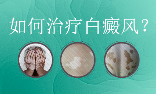 白癜风的医治有哪些要注意的呢